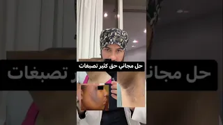 علاج التصبغات الجلدية العميقة طبيعيا في المنزل Skin Pigmentation 