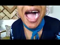 OPEN MOUTH BURPS CLOSE UP BURPS EXCESSIVE BURPING