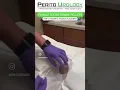 Testosterone Pellet Placement