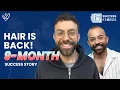Success Story: 9 Months After Hair Transplant in Turkey | Gus Constantellis