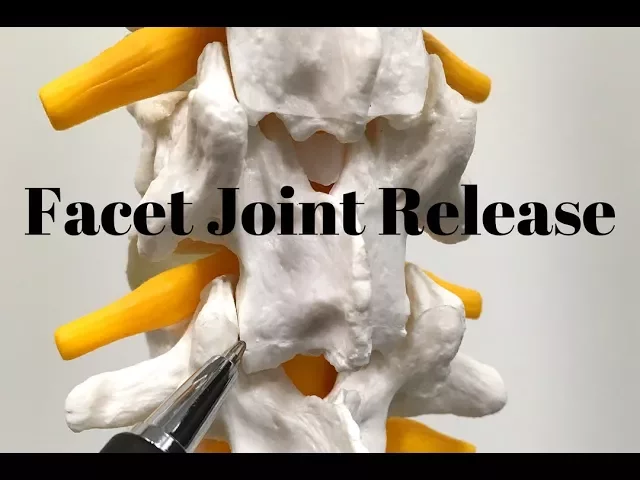 Facet Syndrome Release