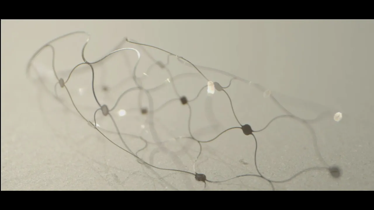 Stentrode brain computer interface online in first two human patients