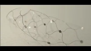 Pogledaj video: Pacijent demonstrira mogućnosti Synchronovog interfejsa