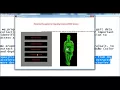 Medical Image Processing Projects Using Matlab Medical Image Processing Thesis Using Matlab
