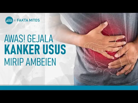 Kanker Usus Nyaris tak Begejala, Begini Cara Deteksinya