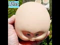2nd Part of Stage 2 Bald CPK Pox Treatment 2