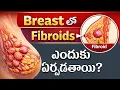 Fibroids vs Breast Cancer Dr Vijay Anand Reddy NSH Healthcare
