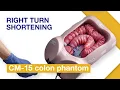 Basic Techniques of Colonoscope Insertion Exercise 1 Right turn shortening