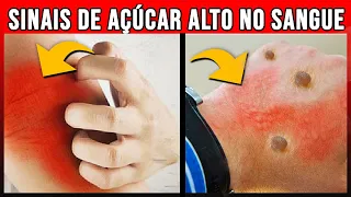 7 Segredos Para Baixar Glicose No Sangue Naturalmente Rápido