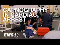 Capnography during CPR 5 things to know