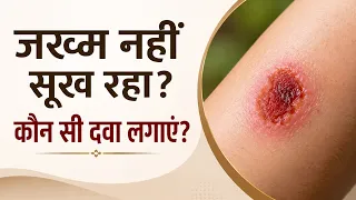 जख्म नहीं सूख रहा? कौन सी दवा लगाएं | Best Medicine for Wound Healing | Hindi | Pharmarocks Medicine