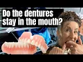 Lagu Dentures in the mortuary