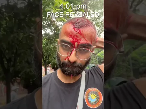 Bloodiest face reveal in YouTube’s history?