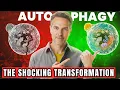 Download Lagu Autofagie uitgelegd: 7 voordelen en hoe u uw genezingspotentieel kunt ontsluiten