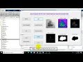 Skin Disease detection using Matlab