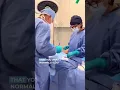 Cell Saver Faster Recovery and Enhanced Energy in Liposuction