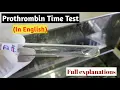 Download Lagu Prothrombin Time Test in English/Prothrombin Time/Prothrombin Time test procedure/STAR LABORATORY