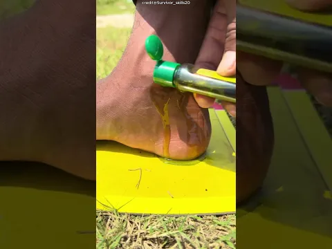 😱 ¡Su pie quedó atrapado en pegamento para ratones! ¡El aceite lo salvó! 😂 #Shorts