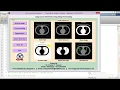 Lung Cancer Detection and Classification Using Image Processing Matlab Project Code