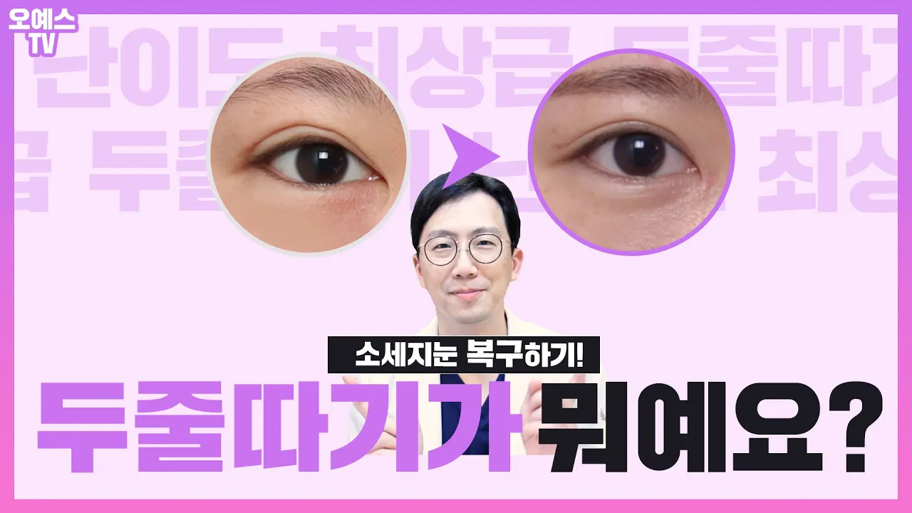 Q. 두줄따기가 뭐에요? A. 망한 소세지눈을 복구할 수 있는 방법!