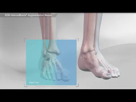 Arthrex Software demo animation