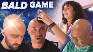 Scientifically Measuring Who s The Most Bald
