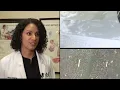 ANF Feature on How Atlanta Allergy Asthma Tracks Pollen and What It Means for Your Allergies