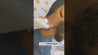 راح نبدأ من جديد في دولة جديد ورحلة علاج جديدة بإذن الله 