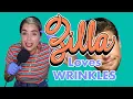 Comedian Renames Her Wrinkles