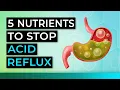 Top 5 Supplements to Stop Acid Reflux Forever