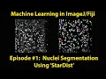 Machine Learning in - StarDist