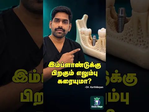 இம்பிளான்ட்டுக்கு பிறகும் எலும்பு கரையுமா? - Implant Bone Loss | Dr. Karthikeyan | Denta Kings