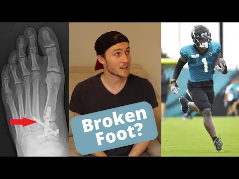 Lisfranc Injuries in the NFL Travis Etiennes Foot
