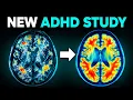 What Happens To Your AD Brain After 30 Days of NO Sugar