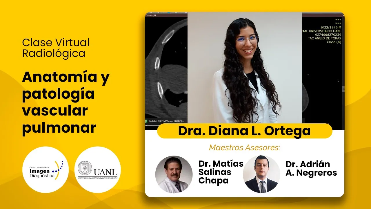 Anatomía y patología vascular pulmonar. Dra. Diana Ortega