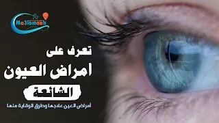 ما هي أمراض العيون الشائعة وأسبابها وطرق الوقاية منها   دندنها