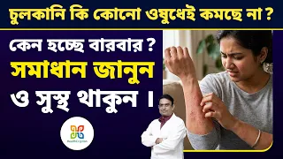চুলকানি মানেই ফাঙ্গল ইনফেকশন নয় হতে পারে কোনো বড় রোগের লক্ষণ।  4 Different type of itching.  
