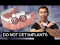 Don t Get Implants Until You Know This Dentists Don t Tell You The Truth