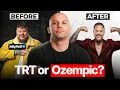 Jelly Roll s 300 LB Transformation Exposed Everything Wrong with the Fitness Industry