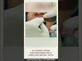 Download Lagu All ceramic crown/ Dental cap for a discolored black tooth.