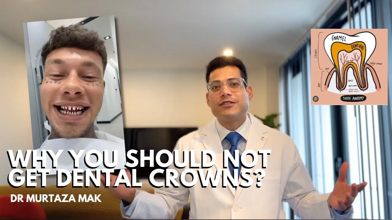Outline Video Why You Should Not Get Dental Crowns? The Unfortunate Truth