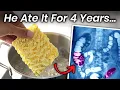 Lagu A Boy Ate Instant Noodles for 4 Years, This Is What Happened to His Stomach