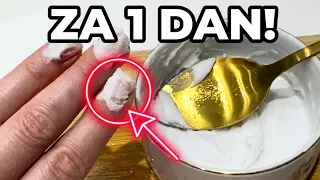 Ako imate žute i lomljive nokte – SAMO 2 SASTOJKA! Rezultat je šokirajući!