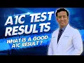 A1C test for Diabetes HbA1c - What is a Good A1C Test Result SUGARMD