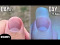 Download Lagu 100 Days Of Fingernail Growth - Time Lapse #shorts