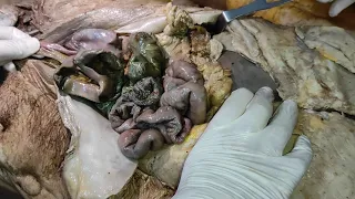 تشريح المعدة والأمعاء ج2 