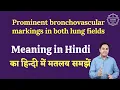 Prominent bronchovascular markings in both lung fields meaning in Hindi English to hindi