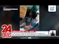 Download Lagu 25-anyos na PWD na binugbog at tinaser sa bus, nagreklamo vs. bus driver at konduktor | 24 Oras