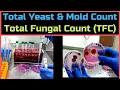 Total Yeast Mold Count Total Fungal Count - A Complete Procedure BAM Ch-18