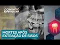 Download Lagu Casos de morte após extração de sisos geram investigação e mobilização